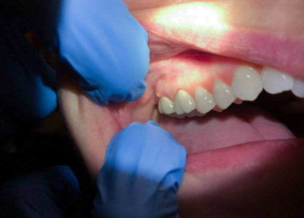 Best Urgent Dental Care for Toothache in Christopher, IL